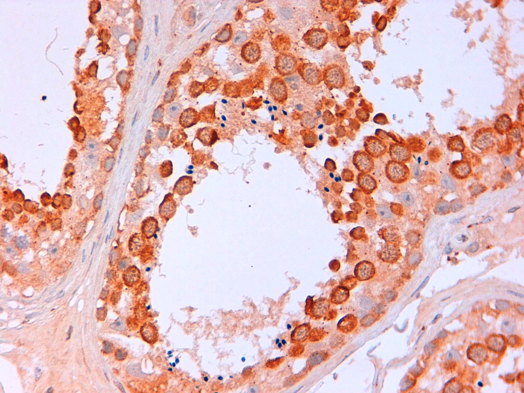 Immunohistochemical staining of FFPE human testis using DDX antibody at 5 µg/ml visualized using goat anti-rabbit-HRP secondary and DAB substrate at pH 6.2.  Pathologist comment: Very good staining on germ cell testicular @ pH6.2, little background on tissue.